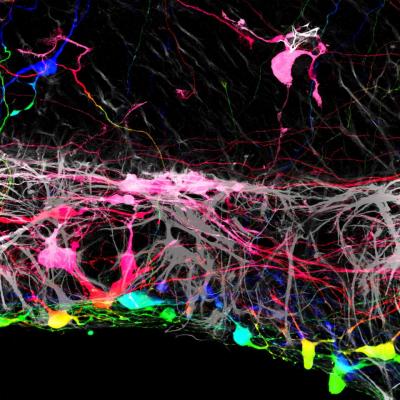 Multicolored nerve cells with many dendrites