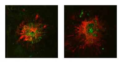 Side-by-side microscopy images showing larger amounts of red on the right-hand image