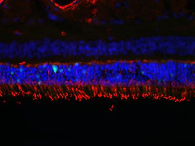 Image shows cone cells, labeled in red.