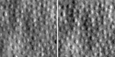 Cone photoreceptors imaged in a human eye 