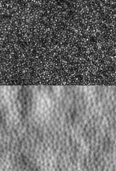 Cone photoreceptor cells in a living human eye