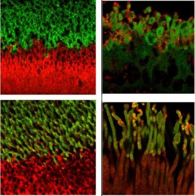 Four micrographs of red and green labeled retinas