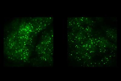 Side-by-side fields of green fluorescent cells