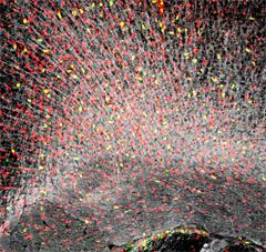 Image of brain cells with "sparks" of red and yellow