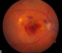 eye close up