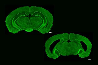 Cross-sections of mouse brain