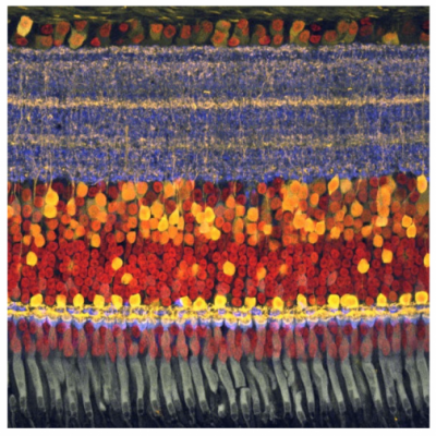 Colored micrograph showing layers of the chick retina