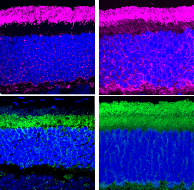 Four fluorescently stained cross sections of mouse retinal tissue