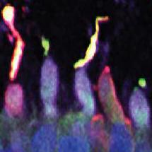 Cone photoreceptors from retinal organoids