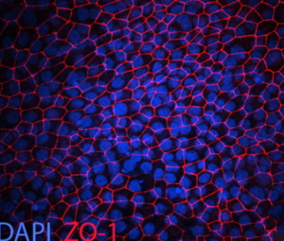 Immunocytochemistry analysis demonstrated expression