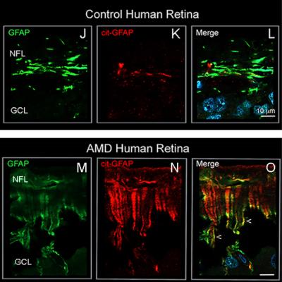 Thumbnail of Muller glia