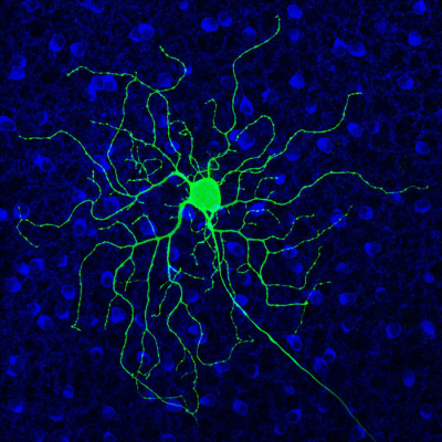 Green retinal ganglion cell spreads dendrites in all directions.