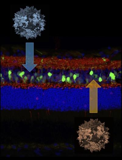 Stained image of retina
