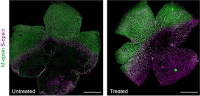 Treated and untreated mouse retinas stained in green and magenta