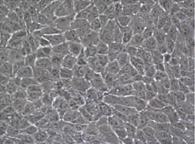 ABC cells in culture