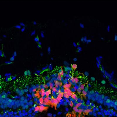 Photoreceptor precursors