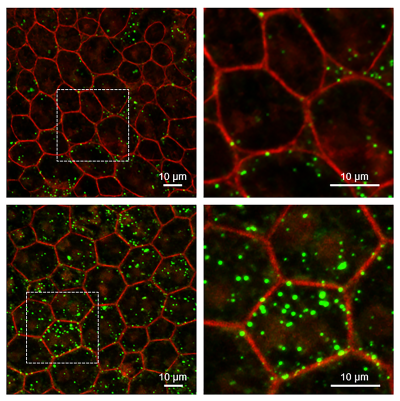 Field of RPE cells with few small (upper) or many large (lower) clumps of lipids