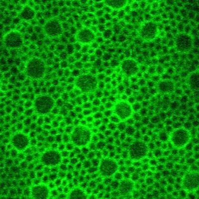 Fluorescently-labeled external limiting membrane encircling cone and rod photoreceptors.