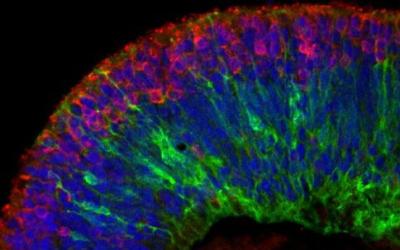 Fluorencent microscope image of retinal organoid colored in red, blue and green