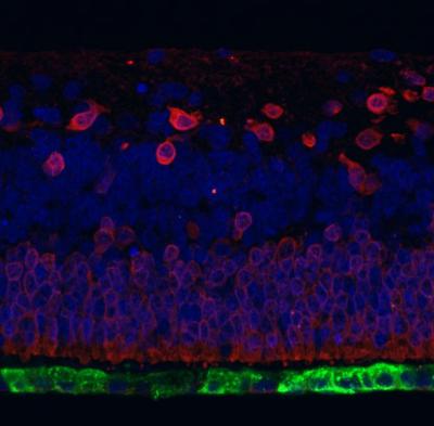 Fluorescent microscope image of retinal organoid with red and blue staining of columnar cells and green cells at the base.