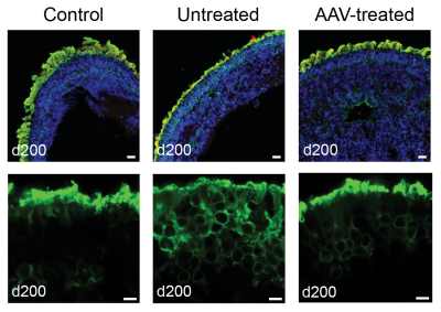 Panel of 6 NPHP5 retinal organoid micrographs.