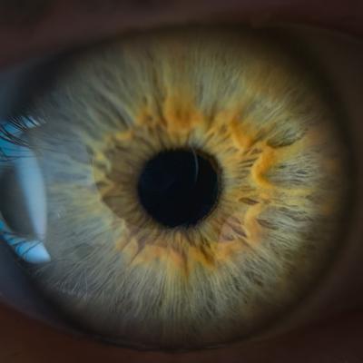 Face-on view of an iris and pupil