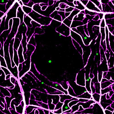Erythrocytes in stasis captured within the choriocapillaris (green) and overlying parafoveal retinal capillaries (magenta). Read the associated publication.