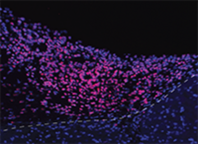 Microscopy image shows border between organoid and surrounding brain tissue.