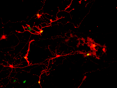 Microscopy image of red fluorescent retinal neurons