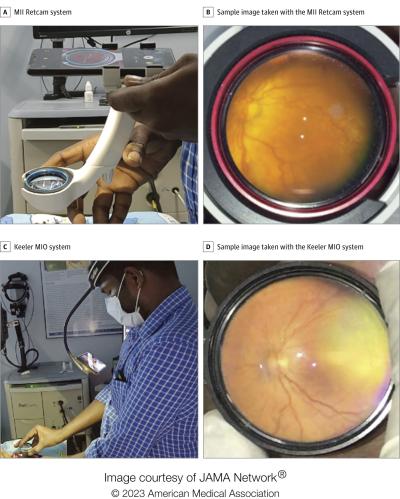 Closeup view of the MII Retcam and Keeler MIO systems, with sample fundus photos.