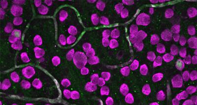Retinal ganglion cells