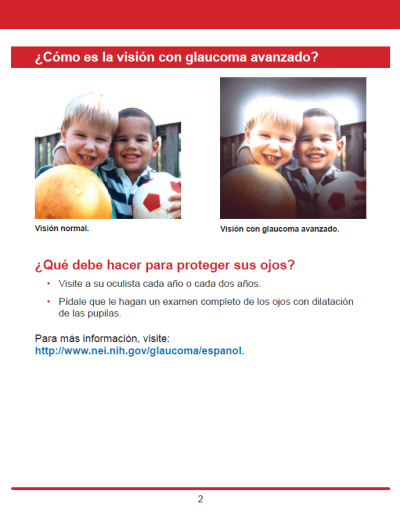 La visión con glaucoma.