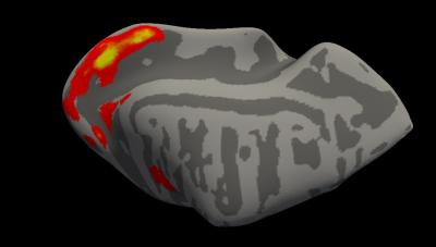 fMRI of dog brain showing bright activation in the visual cortex.