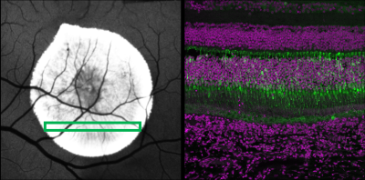 Left: injection site on the retina with green box indicating slice imaged on right.