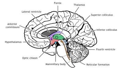 Schematic showing regions of the brain.