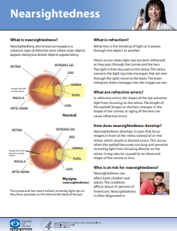 Myopia nearsightedness thumbnail