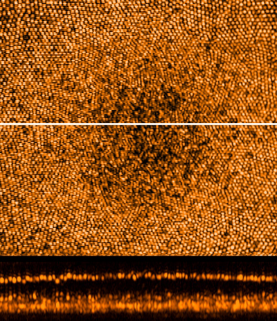 Sub-diffraction limit image of foveal cone photoreceptors