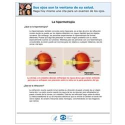La Hipermetropia (Farsightedness)