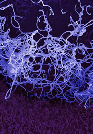 Ebola virus, isolated in November 2014 from patient blood samples obtained in Mali. The virus was isolated on Vero cells in a BSL-4 suite at NIAID Rocky Mountain Laboratories. Credit: NIAID