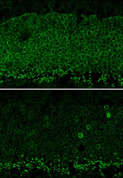 Image of a mouse retina