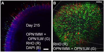 Multiphoton images show the outer segments of cone and rod photoreceptor cells in 215-day retinal organoids. Immunostaining shows a marker for cones (green) and rods (red). The “A” view shows optical sections; “B” is a reconstructed three-dimensional view.