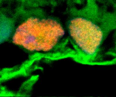 Photo shows microscopy image of exosomes in green surrounding retinal ganglion cells in yellow and orange.