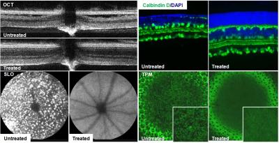 Retinal degeneration in mice
