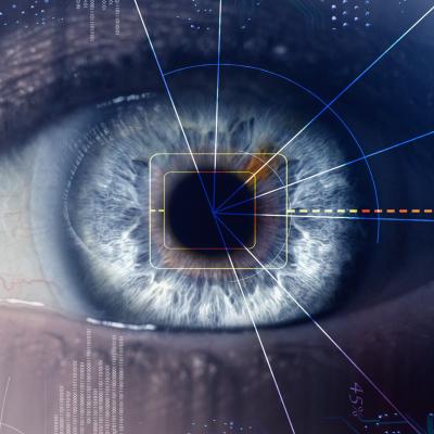 Eye