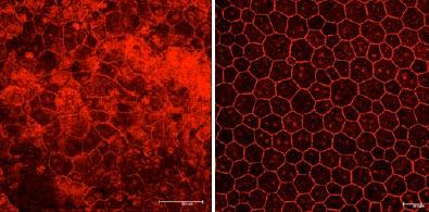 Degenerated RPE cells from mice with geographic atrophy are shown at left. Treating the mice with NRTIs protected the RPE cells. Photos courtesy of Jayakrishna Ambati, M.D.
