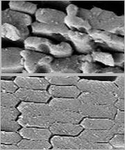 Mice with AQP0 mutations (top) had disorderly fiber cells compared to mice with healthy AQP0.