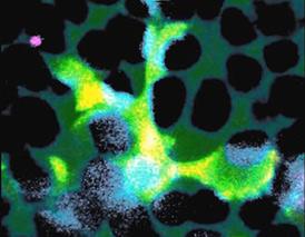 A microglial cell (green) extends spider-like arms to capture and consume rod photoreceptor cells (blue). Credit: Dr. Wai Wong, NEI.