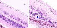 A healthy mouse retina (left) and distinctive folds in a mouse retina damaged by autoimmune uveitis (right). Credit: Wang et al. Nature Medicine, April 2014.
