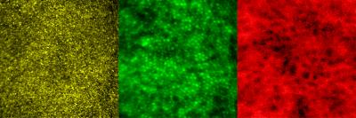 Images show multimodal technique using adaptive optics and angiography to simultaneously see photoreceptors (left), retinal pigment epithelial cells (center), and choriocapillaris in the living human eye.