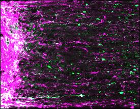 Regenerating mouse retinal ganglion cell axons (magenta and green) extending from site of optic nerve injury (left). Photo courtesy of Andrew D. Huberman.